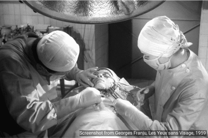 face transplants